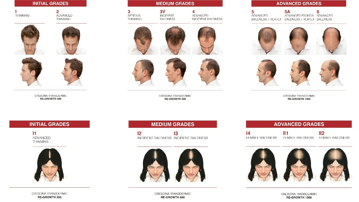 Crescina-ampoules-cheveux-pharmaglobe