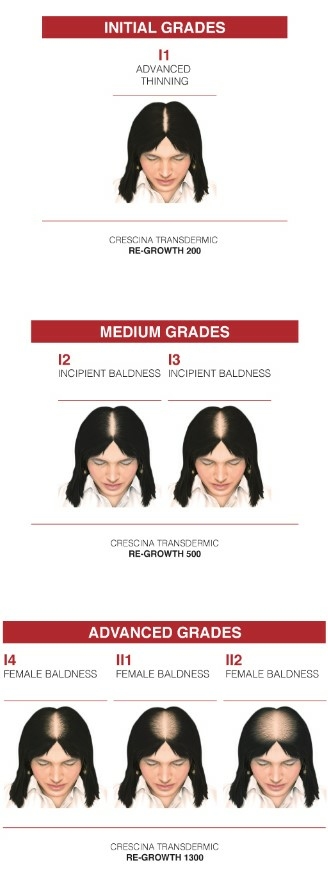 Crescina-transdermic-HFSC-tableau-chute-cheveux-pharmaglobe