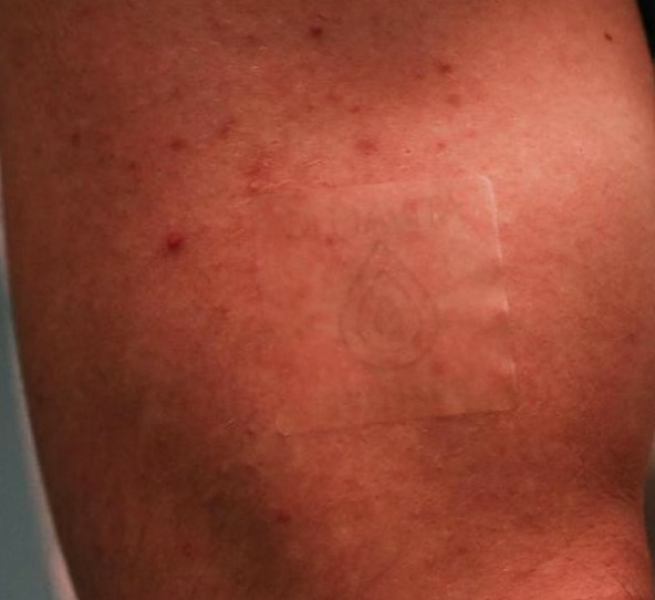 olmavita-patch-au-cbd-premium-24-mg-cbd-2x6-patchs-pharmacie-en-ligne-luxembourg-pharmaglobe.lu