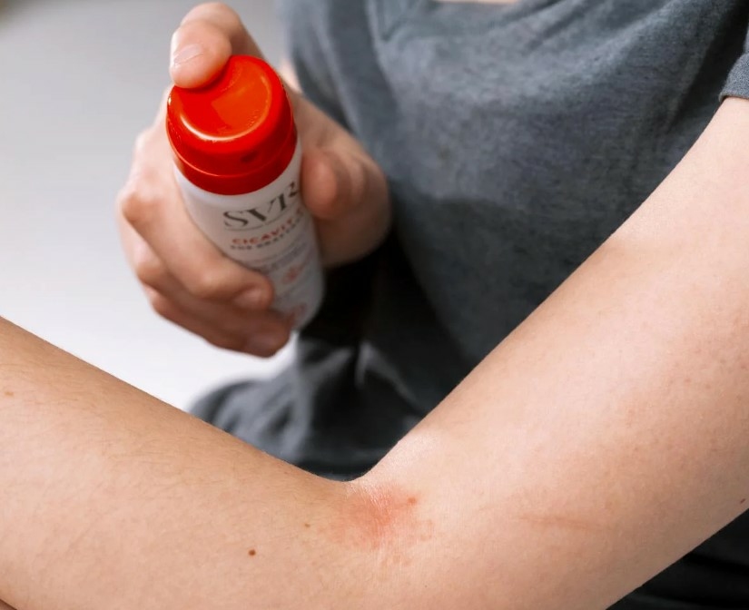 svr-cicavit-plus-sos-spray-anti-grattage-apaisant-flacon-75ml-produit-promo-vente-prix-web-avis-pharmacie-en-ligne-luxembourg-pharmaglobe.lu