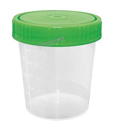 gobelet-urine-volume-125ml-bouchon-vis-vert-pharmaglobe.lu